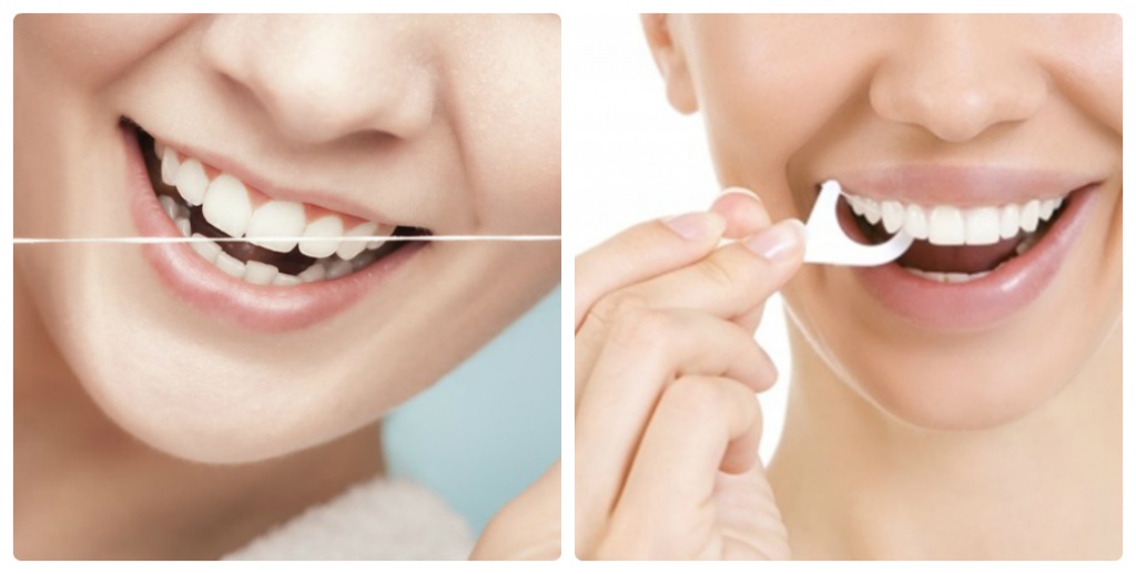 Nên và không nên làm gì sau khi trám răng thẩm mỹ Nên và không nên làm gì sau khi trám răng thẩm mỹ